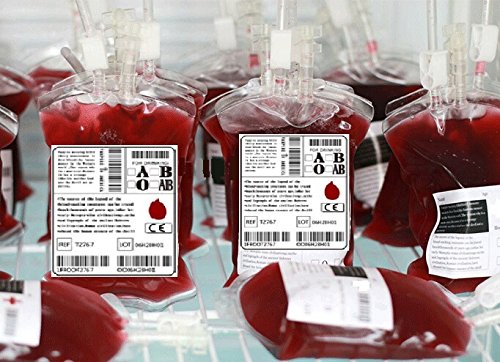 One way to know your blood type is through blood donation process
