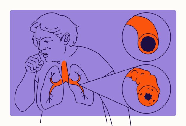 Symptoms of chronic obstructive pulmonary disease
