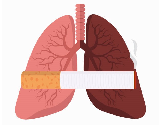 Comprehensive Overview of Chronic Obstructive Pulmonary Disease (COPD)