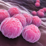 Are any STDs curable?