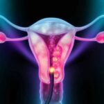 4 Ways to Detect Cervical Cancer