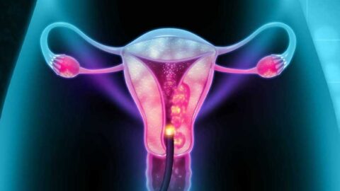 4 Ways to Detect Cervical Cancer