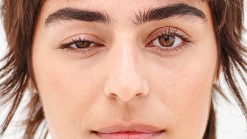 Ptosis: Causes & Treatment