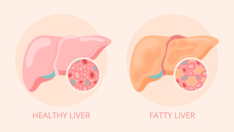 Dangerous Complications of Fatty Liver Disease