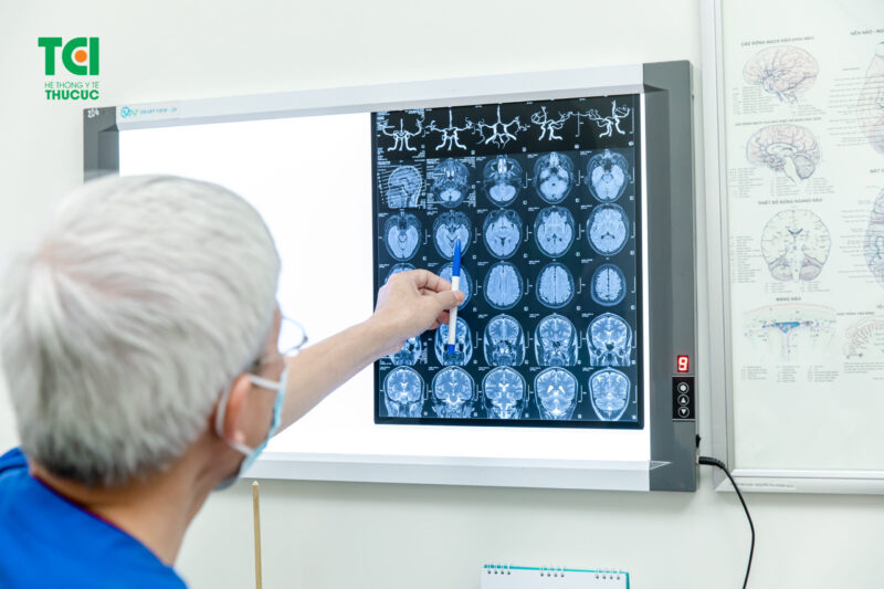 Brain MRI: What You Need to Know - TCI Hospital EN