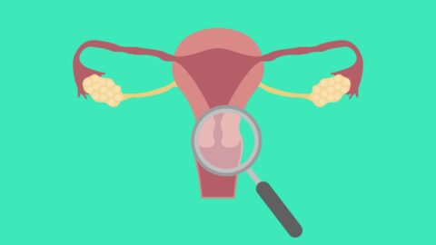Cervical Cancer Screening Methods
