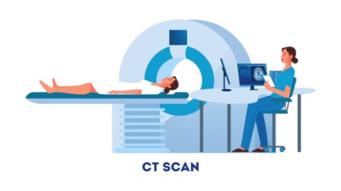 What is Computed Tomography (CT) Scan?