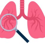 Common Lung Cancer Screening: A Comprehensive Overview