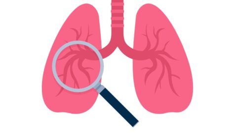 Common Lung Cancer Screening: A Comprehensive Overview