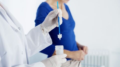PAP Smear for Cervical Cancer Screening: When Should It Be Done?