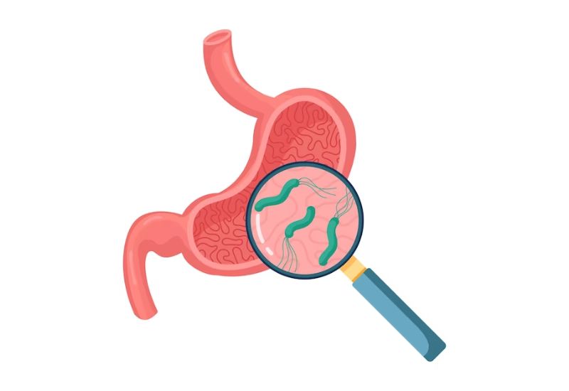 Helicobacter Pylori Infection