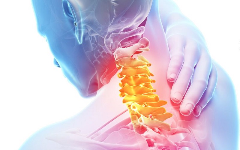 What is Cervical Disc Herniation?