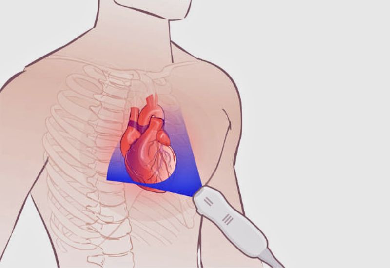 Common Cardiac Ultrasound Techniques