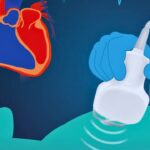 Understanding Cardiac Ultrasound: An Imaging Technique for Heart Diagnosis