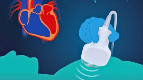 Understanding Cardiac Ultrasound: An Imaging Technique for Heart Diagnosis