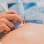 Prenatal Ultrasound: Essential Information for Expectant Mothers