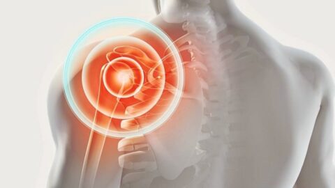 Comprehensive Shoulder Dislocation Treatment Guide