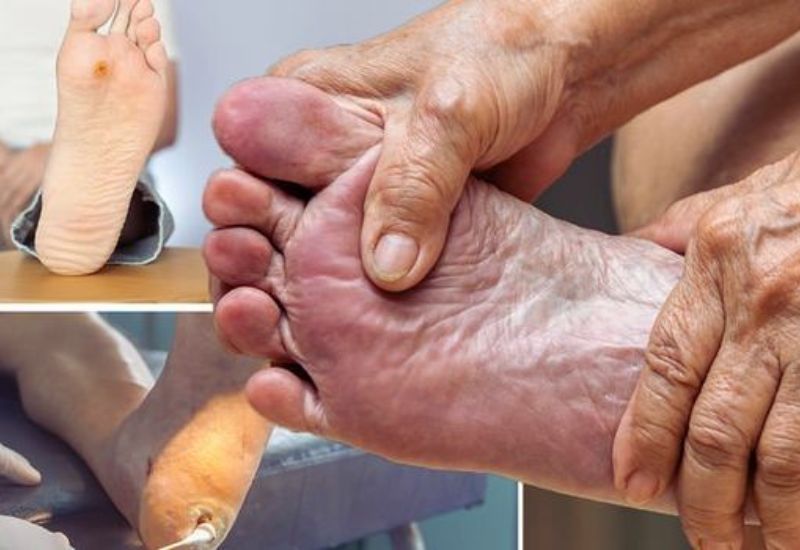 Common Types of Diabetes and Their Symptoms