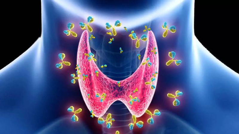 Common Causes of Hyperthyroidism