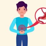 Common Symptoms of Peptic Ulcer Disease and Effective Treatment Approaches