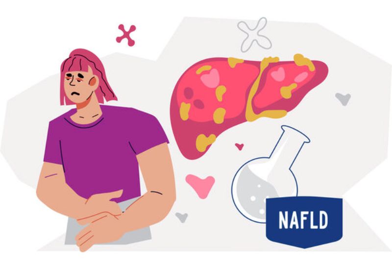 Symptoms of NAFLD