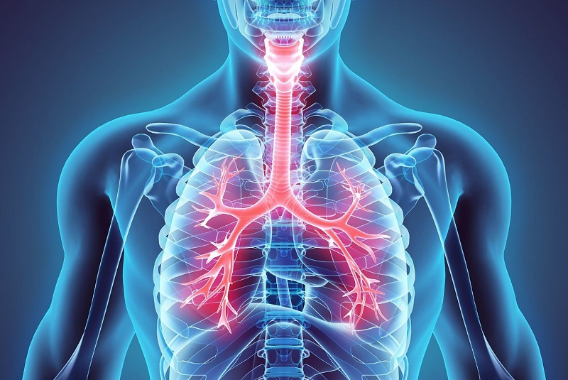 Common Causes of Acute Bronchitis