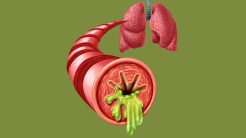 Acute Bronchitis Symptoms and Effective Treatment Options