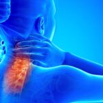 Cervical Spondylosis in Young Adults: Key Early Signs