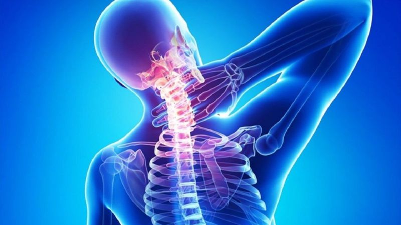 What Is Cervical Spondylosis?