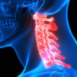 Understanding the Cervical Vertebrae and Related Conditions