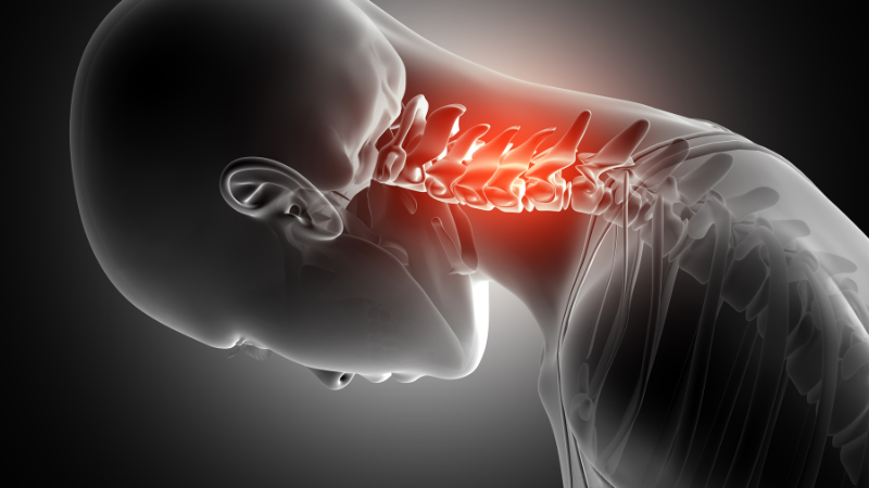 What Are the Cervical Vertebrae?
