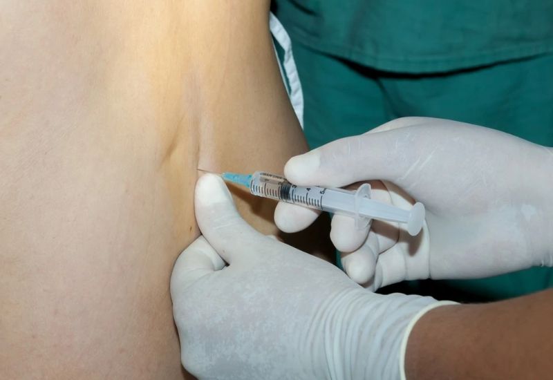 What Is Epidural Analgesia for Post-Cesarean Pain Relief?