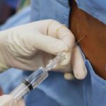 Understanding Epidural Analgesia for Post-Cesarean Pain Relief