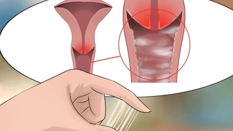 Should women have regular check-ups at a gynecology clinic?