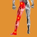 Sciatica: Causes, Symptoms, and Treatment Approaches